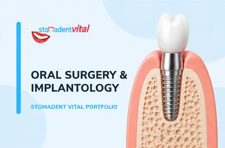 Oral Surgery Implantology