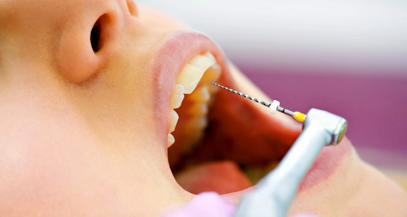 Endodontics